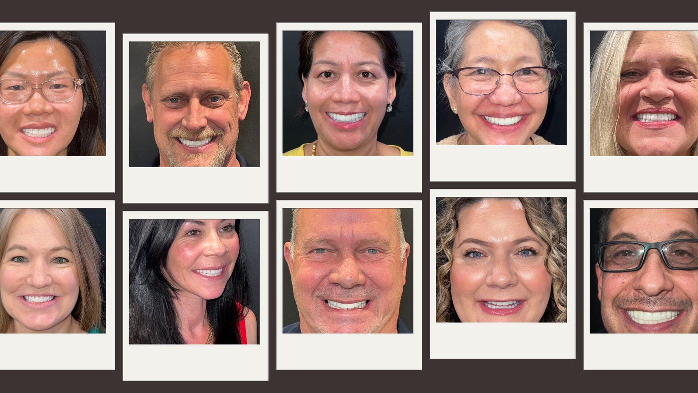 Collage of real Aria Dental Implant Center patients smiling after All-on-4® full-arch dental implant treatment in Phoenix, Arizona