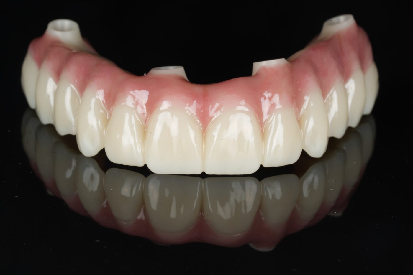 Solid zirconia full-arch implant bridge crafted in the Aria Dental Implant Center in-house digital laboratory in Phoenix, Arizona