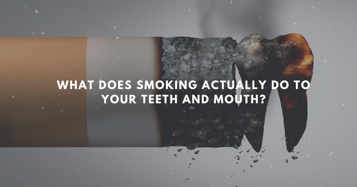 What Does Smoking Actually Do To Your Teeth and Mouth