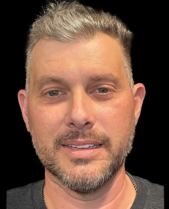 dental implant patient after