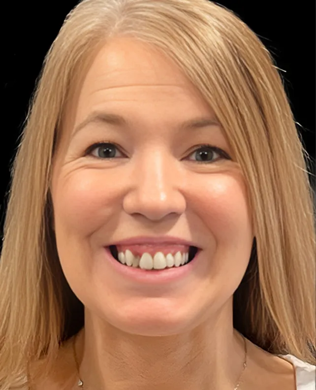 dental implant patient before