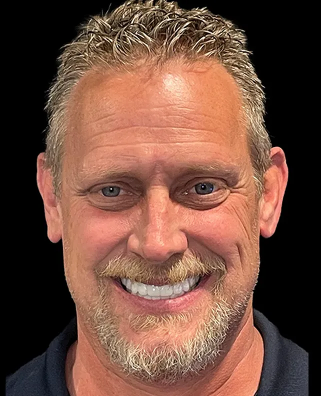 dental implant patient after