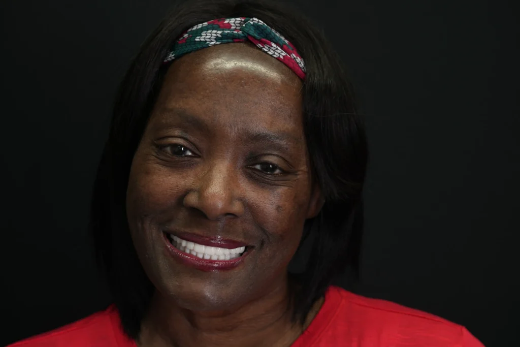 Real Implant Overdentures Patient